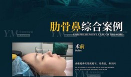 医美爆料事件案例视频播放,揭秘视频背后的真实故事